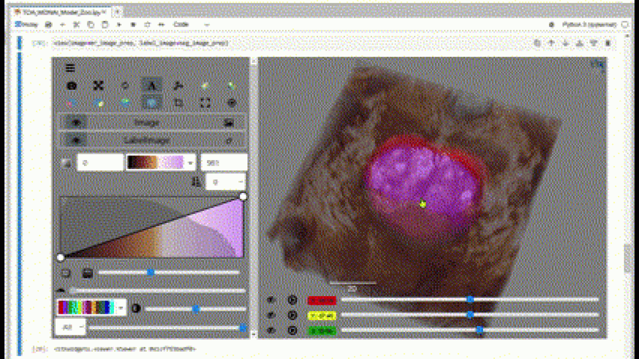 Share medical image research on Amazon SageMaker Studio Lab for free